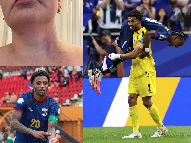 Un nuevo escándalo sacude el Mundial 2026. Ryan Mendes, capitán de la Selección de Cabo Verde -que se enfrentará a Argentina en los 16avos de final de la Copa del Mundo.