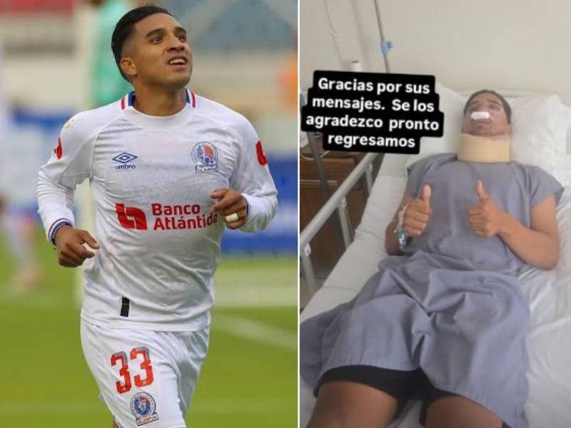 Michaell Chirinos estaría unos dos meses fuera de las canchas luego de la fuerte lesión que sufrió en Olancho.
