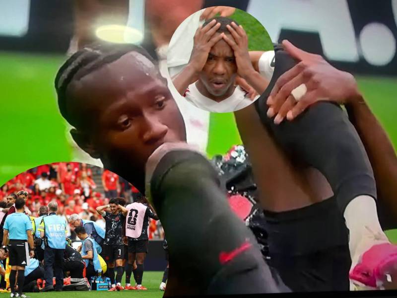 El mediocampista de Canadá abandonó el terreno de juego inmovilizado tras recibir una fuerte entrada de Assim Madibo. Fotos captura de video y cortesía.