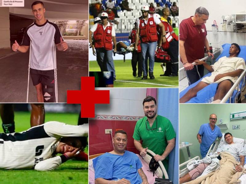 Los futbolistas de la Liga Nacional que se pierden lo que resta del torneo Apertura 2026. El portero Luis 'Buba' López es el último en sumarse a la clínica.