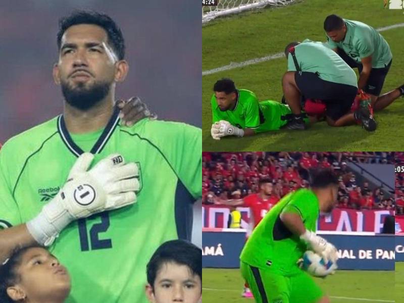 El portero de Panamá sufrió un dolor en pleno partido amistoso entre Panamá contra República Dominicana.