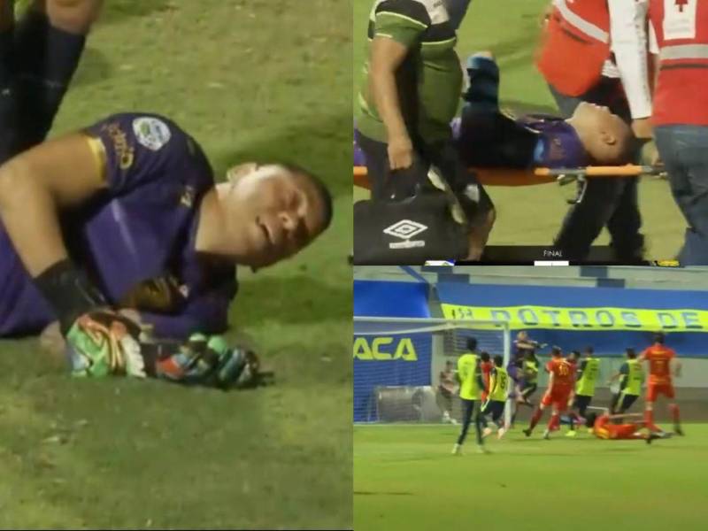Denovan Torres sufre fractura y estará fuera de las canchas
