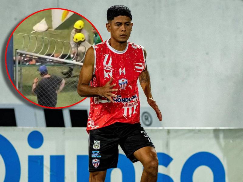 El futbolista de Estrella Roja sufrió un duro golpe en el partido entre Estrella Roja y Marathón.