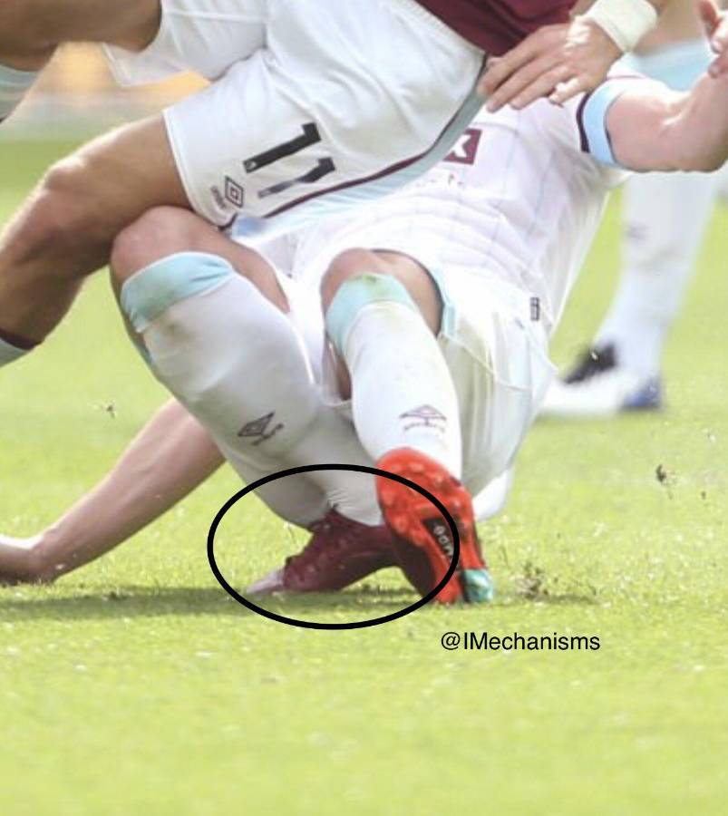 ¡No apto para sensibles! Así quedó el pie: La terrorífica lesión de Ashley Westwood que dejó a varios futbolistas llorando