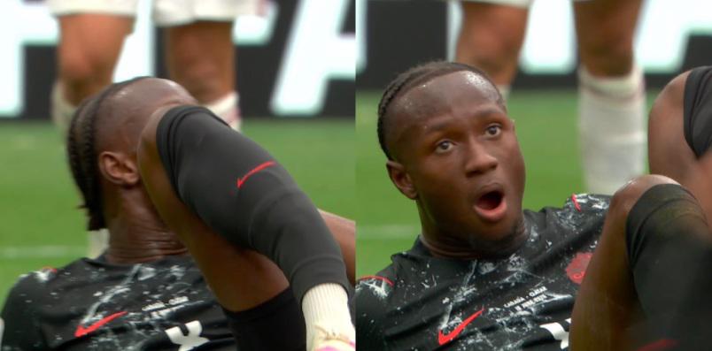 Imágenes sensibles: la escalofriante lesión que sucedió en el Canadá vs. Qatar
