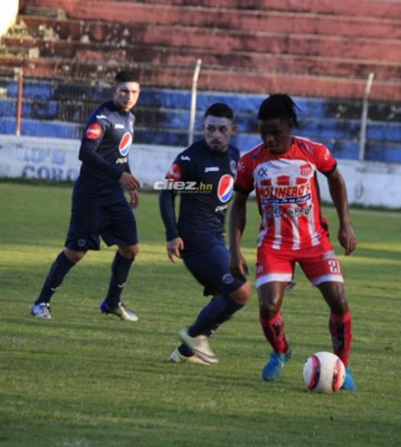 No viste en TV: El rostro de Buba tras la derrota, caras pintadas y el reencuentro de Coito