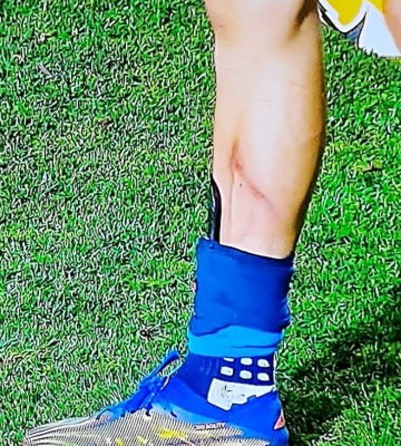 ''Juego de Barbies'': figura de Tigres explota y así quedó la pierna de jugador del América en la Liga MX