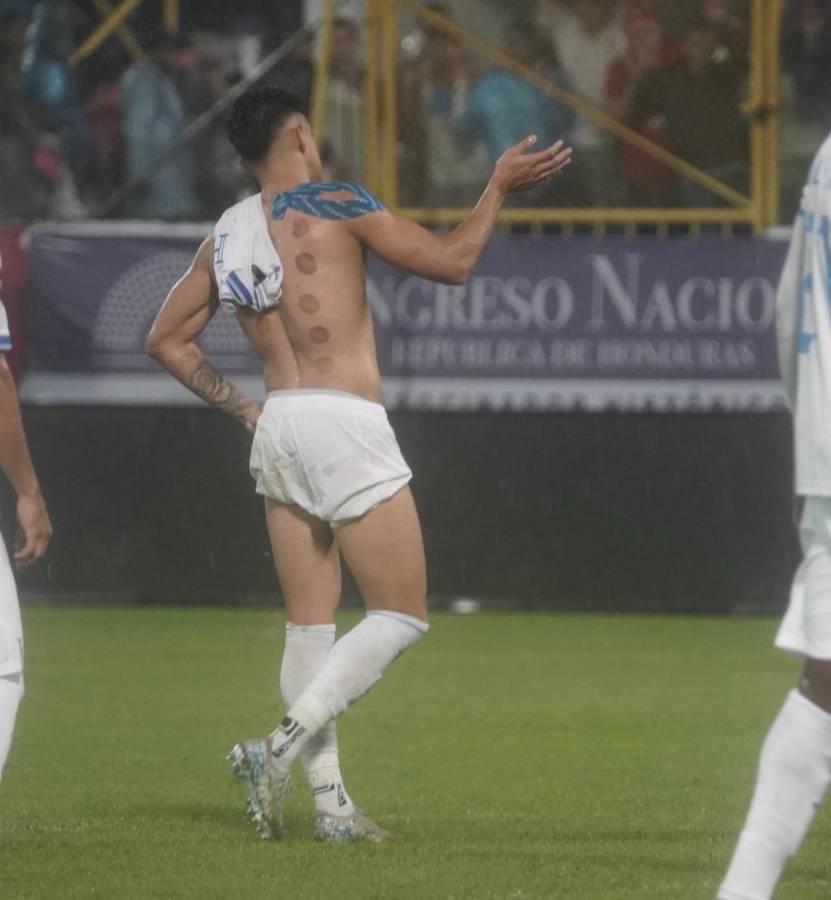 Luis Palma y su noche mágica contra la Selección Mexicana, la marca que impuso con Honduras ¿Por qué tiene moretones en su espalda?