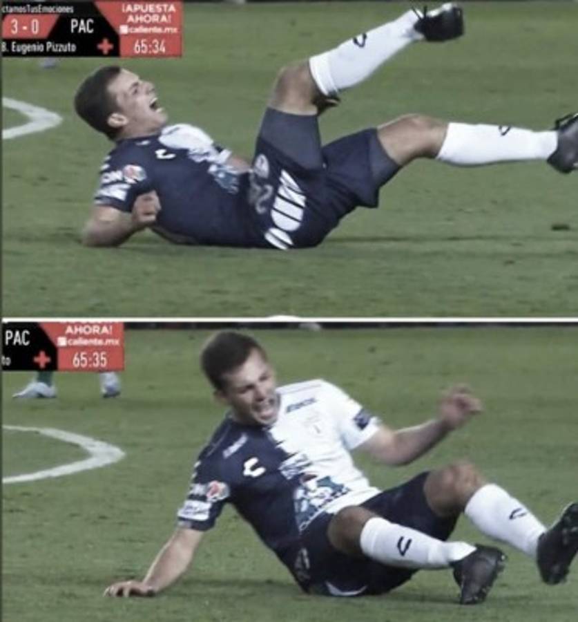 La dura lesión de Eugenio Pizzuto, compañero de Denil Maldonado en Pachuca