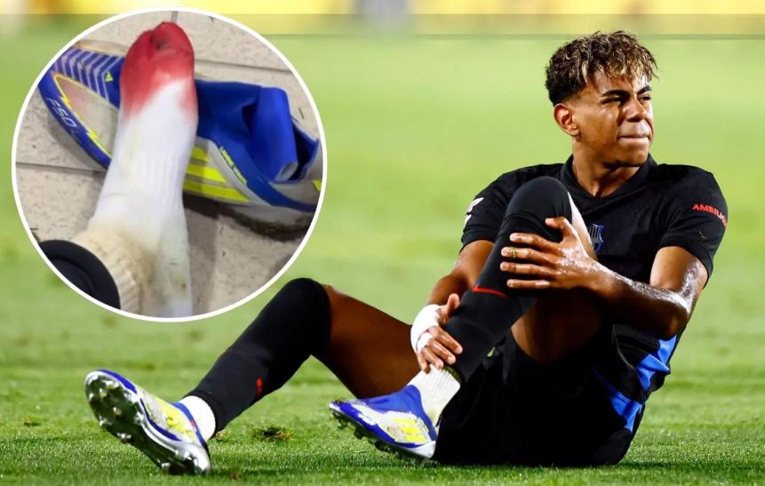 ¿Sin su máxima estrella? Alineación del Barcelona para dar el primer golpe al Atlético en la Copa del Rey