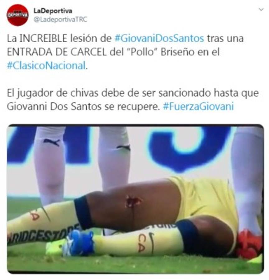 Así reaccionó la prensa mundial tras la grave lesión de Giovanni dos Santos: 'Criminal, de cárcel'