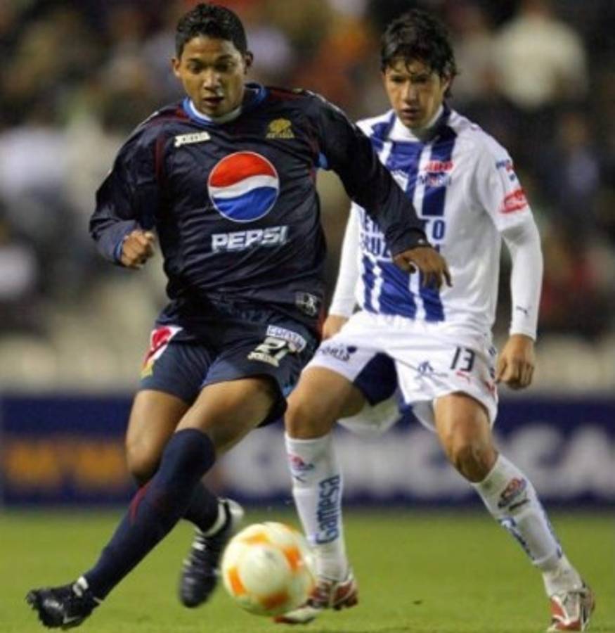 ¡Increíble! Hondureños y catrachas que han sufrido un gran cambio físico