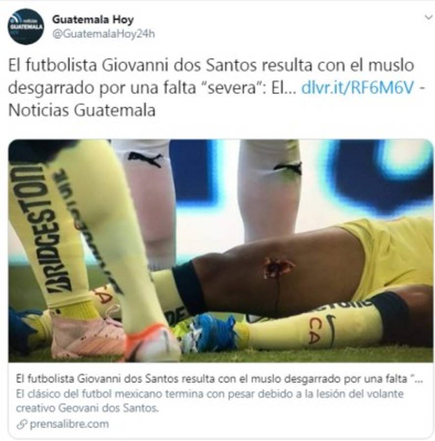 Así reaccionó la prensa mundial tras la grave lesión de Giovanni dos Santos: 'Criminal, de cárcel'