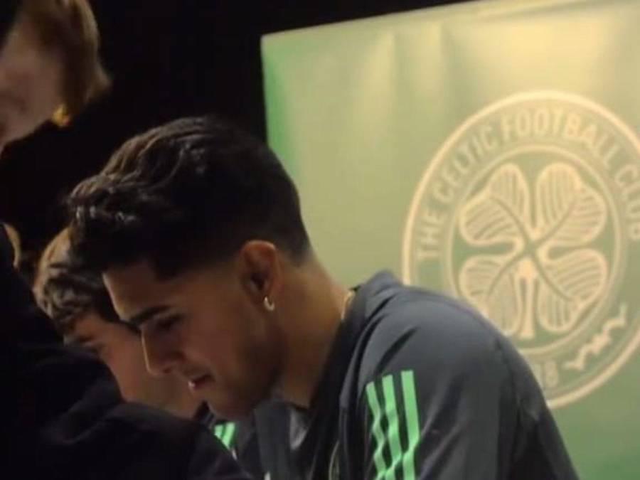 ¡Bichomanía! Luis Palma es sensación en Escocia: Celtic vende souvenirs suyos y los niños lo admiran