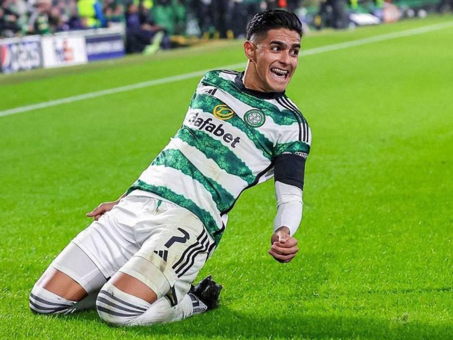 ¡Bichomanía! Luis Palma es sensación en Escocia: Celtic vende souvenirs suyos y los niños lo admiran