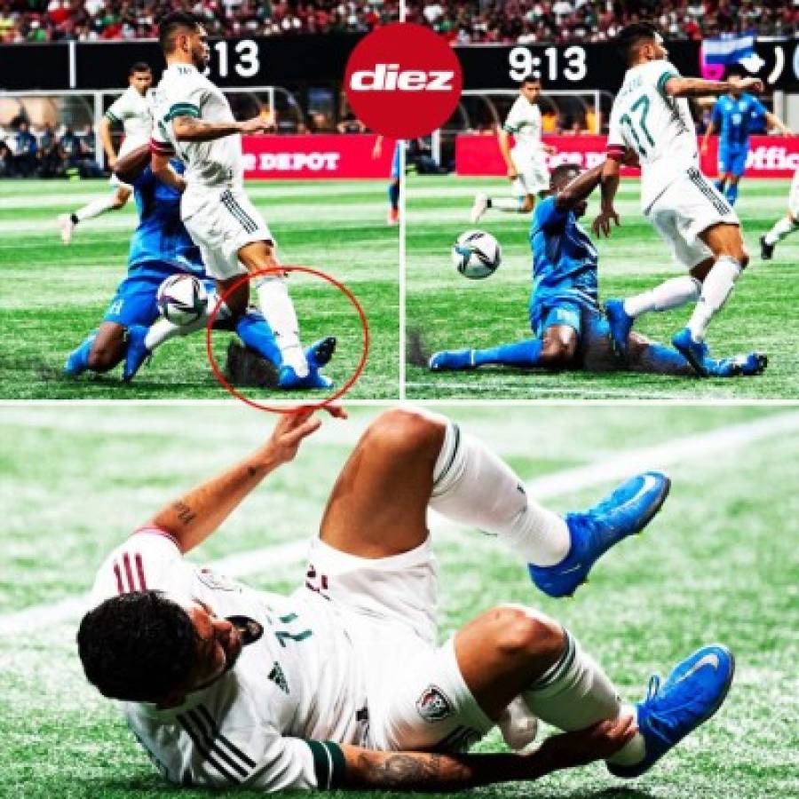 Patadas, agarrones y el espontáneo defendido por futbolistas: Las mejores fotos del Honduras-México en Atlanta