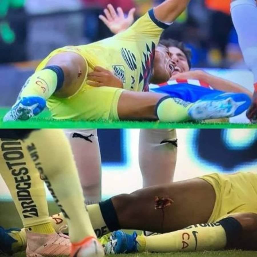 Las impactantes y terroríficas imágenes de la grave lesión de Giovanni dos Santos