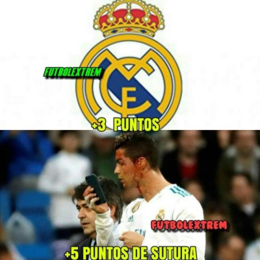 ¡VIRAL! Los memes de Cristiano Ronaldo por mirar su herida en el celular