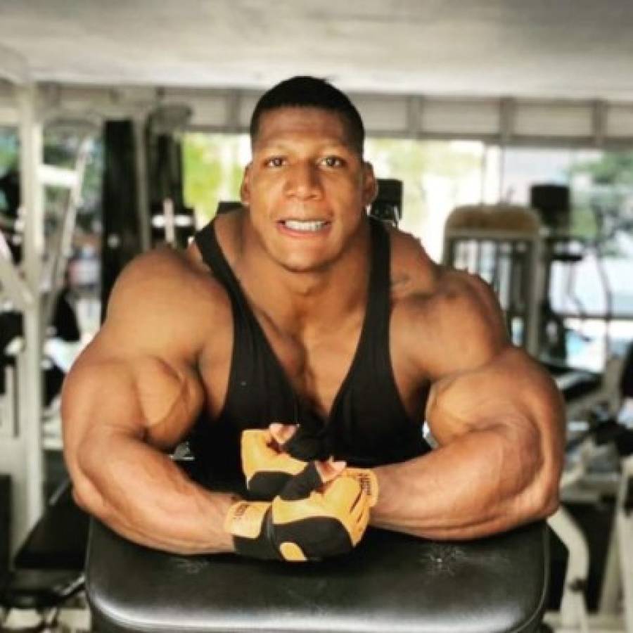 Increíble: Así es Rubiel Mosquera, el hombre con el cuello más grande y