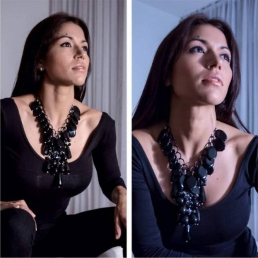 El antes y después de Nora Erazo: Su increíble transformación física