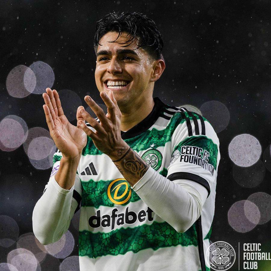 ¡Bichomanía! Luis Palma es sensación en Escocia: Celtic vende souvenirs suyos y los niños lo admiran