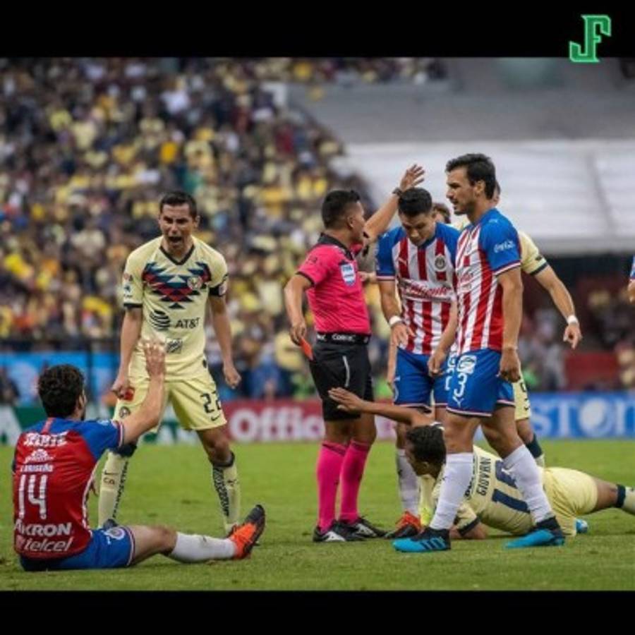 Las impactantes y terroríficas imágenes de la grave lesión de Giovanni dos Santos