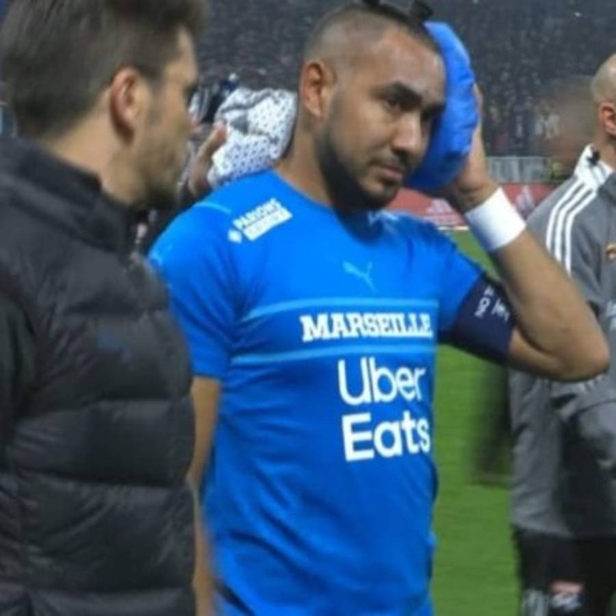 Fotos: Así fue la agresión que sufrió Payet en la Liga de Francia; ¡botellazo en la cabeza!