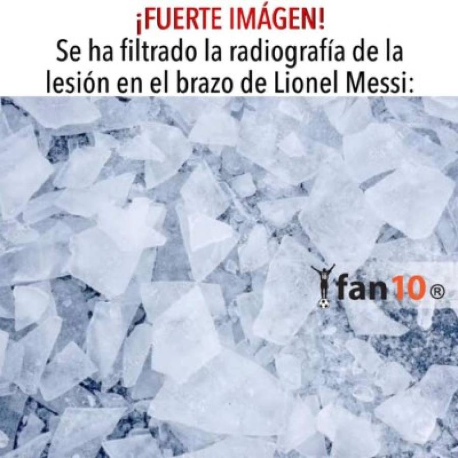 ¡No perdonan! Los memes tras la lesión de Messi; Vidal también es atacado