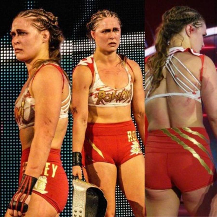 Ronda Rousey muestra sus impactantes lesiones tras la paliza en la WWE