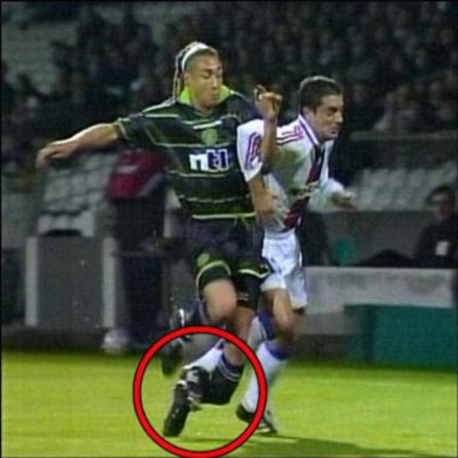 Estas son las lesiones más terribles en la historia del fútbol