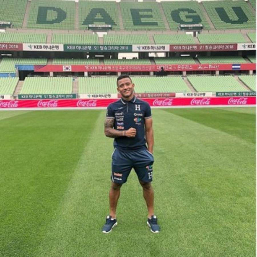 La brutal transformación de Luis Garrido tras la espantosa lesión