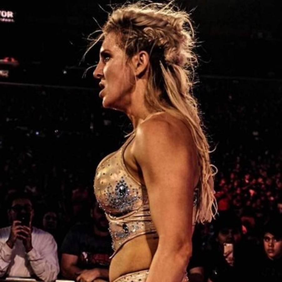 Ronda Rousey muestra sus impactantes lesiones tras la paliza en la WWE