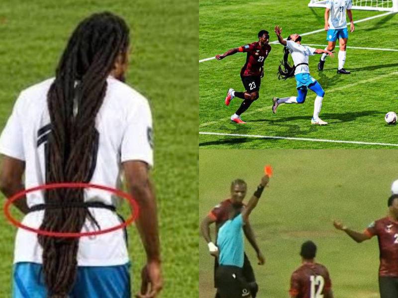 En Concacaf se ha dado una de las imágenes más curiosas de la fecha FIFA. Un solo jugador provocó dos expulsiones por sus trenzas.
