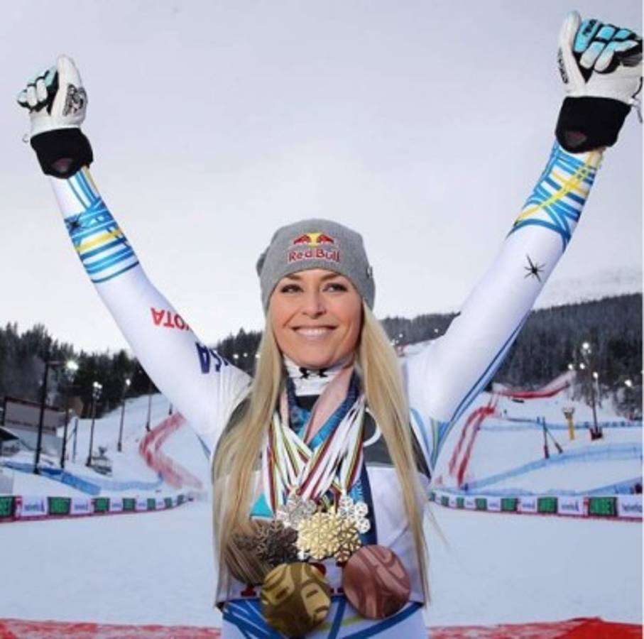 Así luce Lindsey Vonn , la ganadora del Premio Princesa de los Deportes de Asturias