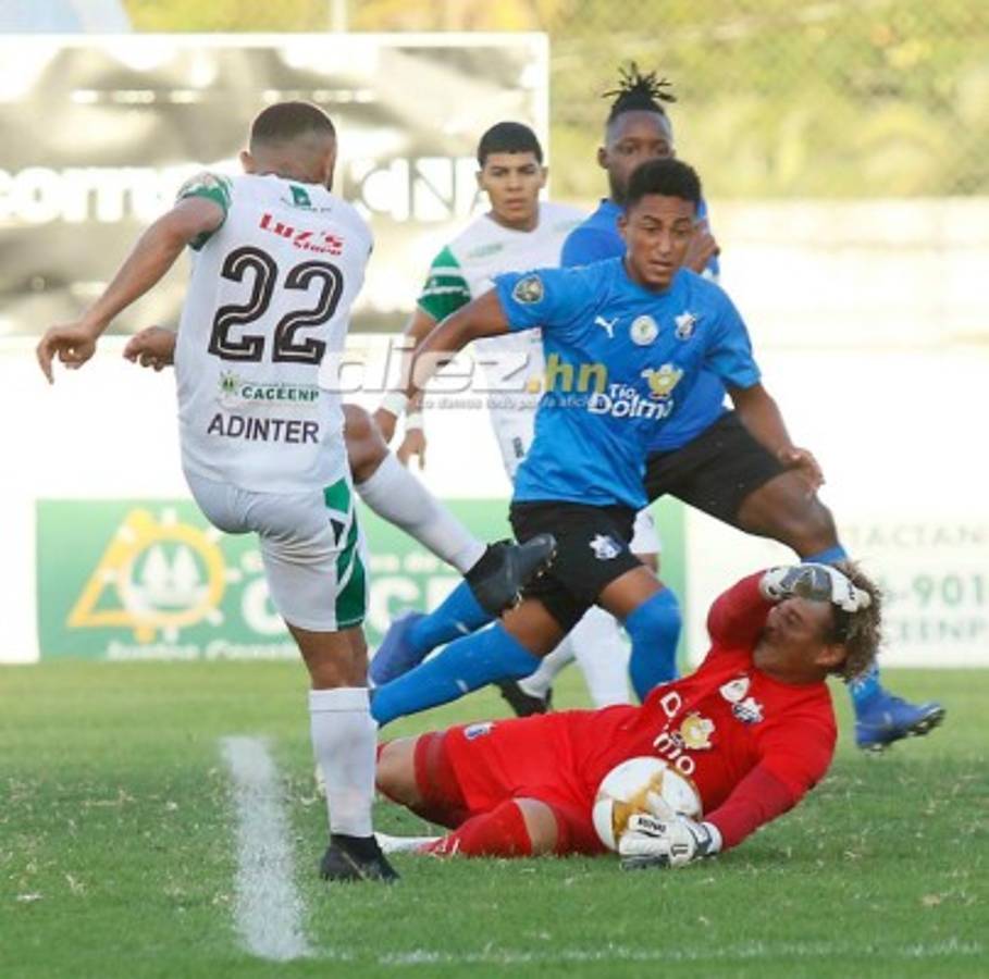 NO VISTE EN TV: Ambientazo, tapadas de Kevin Hernández y lesión de 'Camellito' Delgado