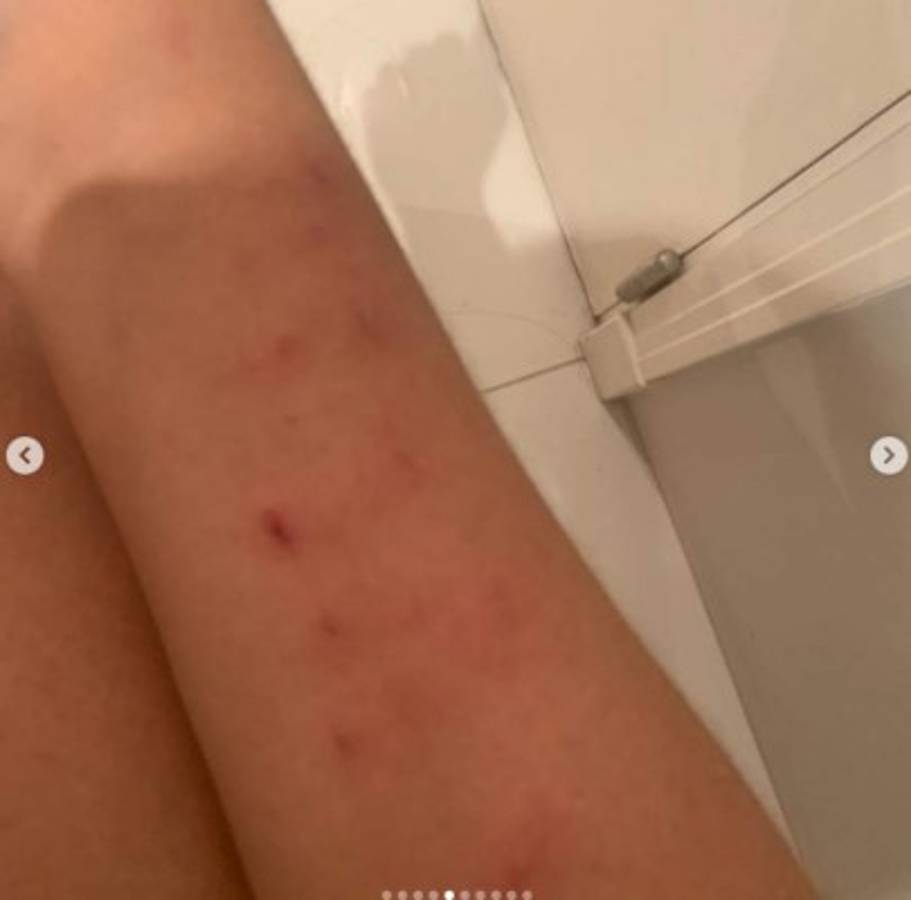 Sebastián Villa, futbolista de Boca Juniors, propinó brutal paliza a su esposa y esta lo denunció