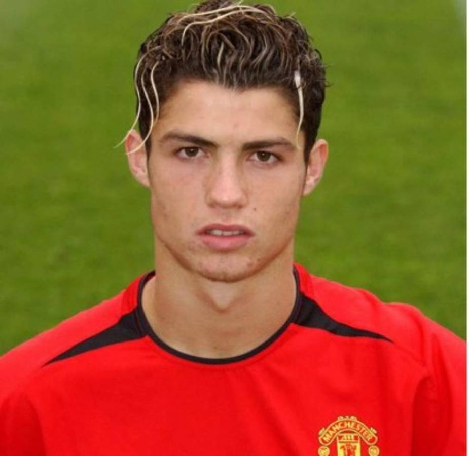 Cristiano Ronaldo: Desvelan las cinco cirugías que se realizó para cambiar su imagen