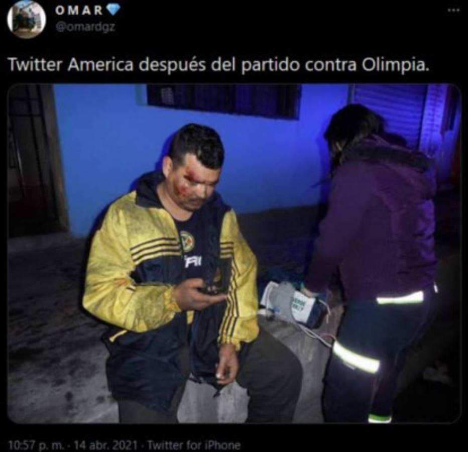En México fulminan al Olimpia: Los otros memes que dejó la derrota del América en el Azteca