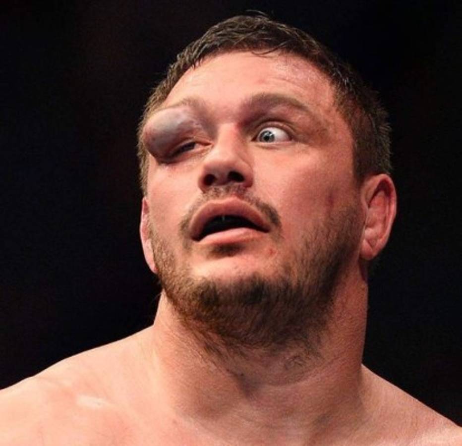 Fotos: Los golpes más espeluznantes en la UFC