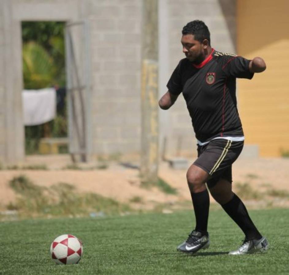 FOTOS: Así es Olvin, el hondureño que juega sin manos