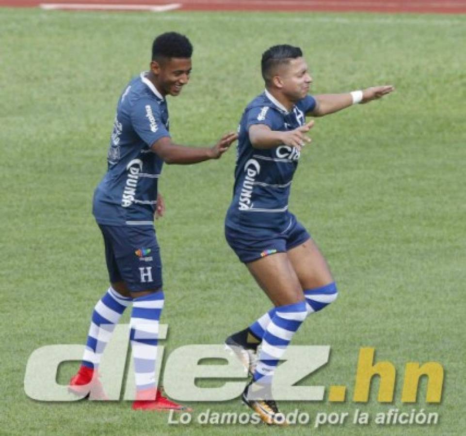 ¡Ufff! Eddie Hernández se quita la máscara y así se ve su ojo; ambiente en Honduras se calienta