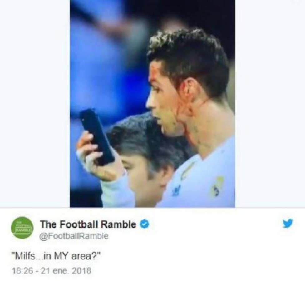 ¡VIRAL! Los memes de Cristiano Ronaldo por mirar su herida en el celular
