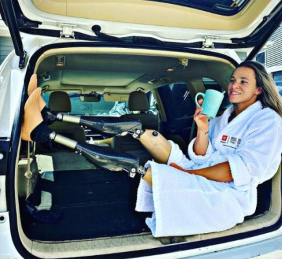 La impactante confesión de Oksana Masters: marcada por la explosión de Chernobyl y sufrió abusos en un orfanato