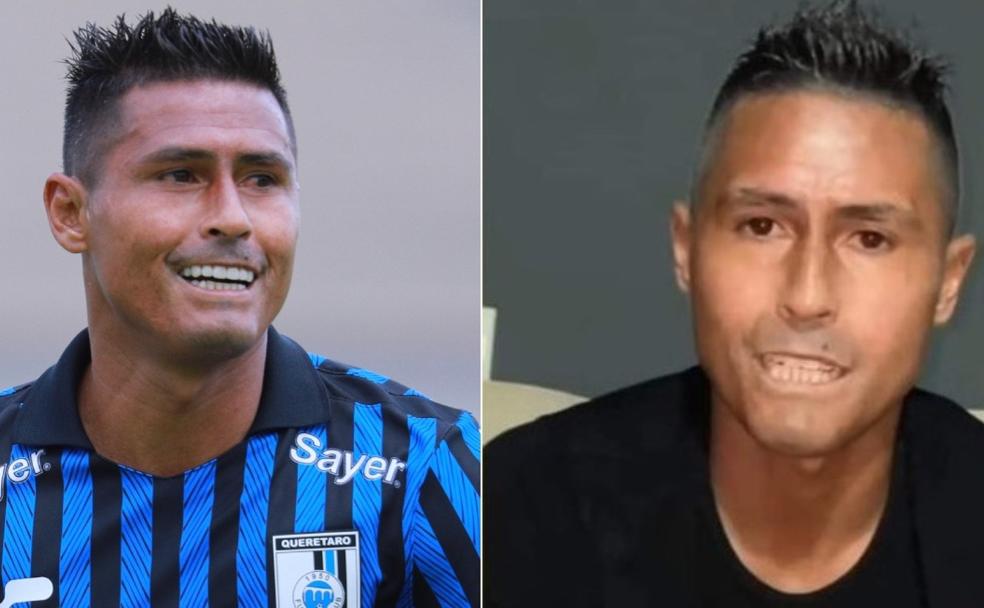 Fue campeón en México y revela la rara enfermedad que deterioró su rostro: Me diagnosticaron...