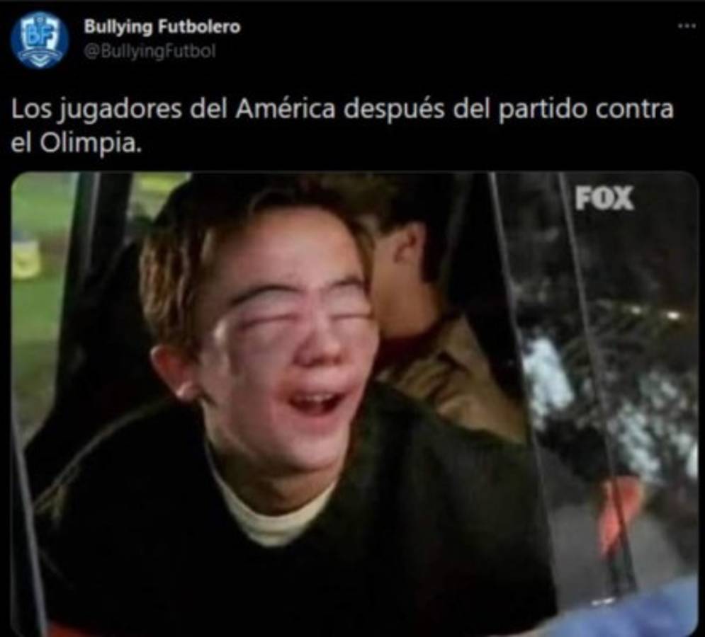 En México fulminan al Olimpia: Los otros memes que dejó la derrota del América en el Azteca