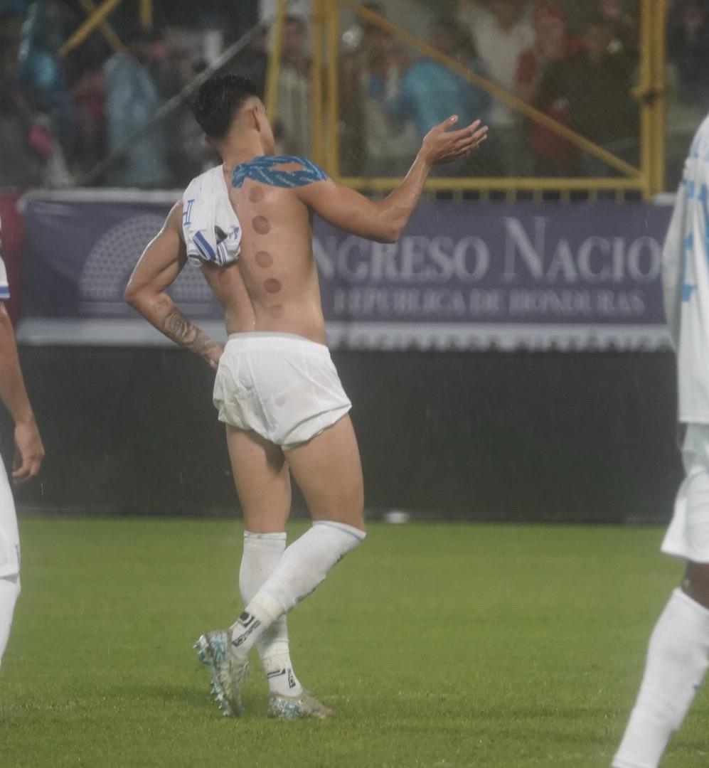 Luis Palma y su noche mágica contra la Selección Mexicana, la marca que impuso con Honduras ¿Por qué tiene moretones en su espalda?